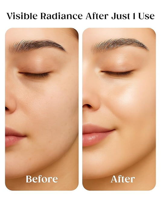 Kaplan MD Clarifying Toner – Hydrating Toner for Face with Hyaluronic Acid, Rosewater, & Aloe Vera – Face Mist for All Skin Types & Pore Tightening and Skin Texture Refining – 3.4 fl oz