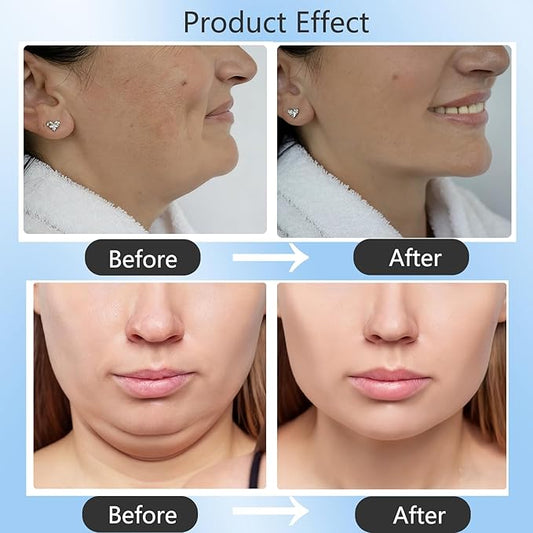 Double Chin Lifting Mask, Reusable Upgraded Double Chin Reducer, Helps Create A Three-Dimensional Jawline, Sleep Mask for Face and Neck Upgraded Deep Collagen Firming Mask (5 Pcs)