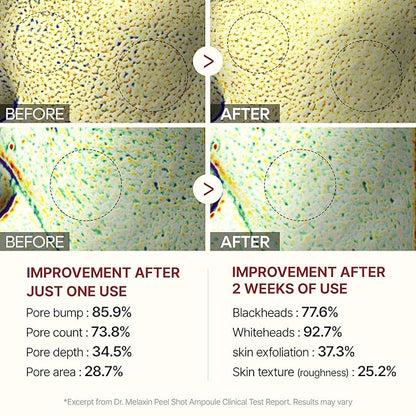 Dr.Melaxin Peel Shot Glow Black Rice Peeling Ampoule 80ml Daily Soft Exfoliating Face and Body Scrub Dead Skin Cells Remover for All Skin Types korean skin care